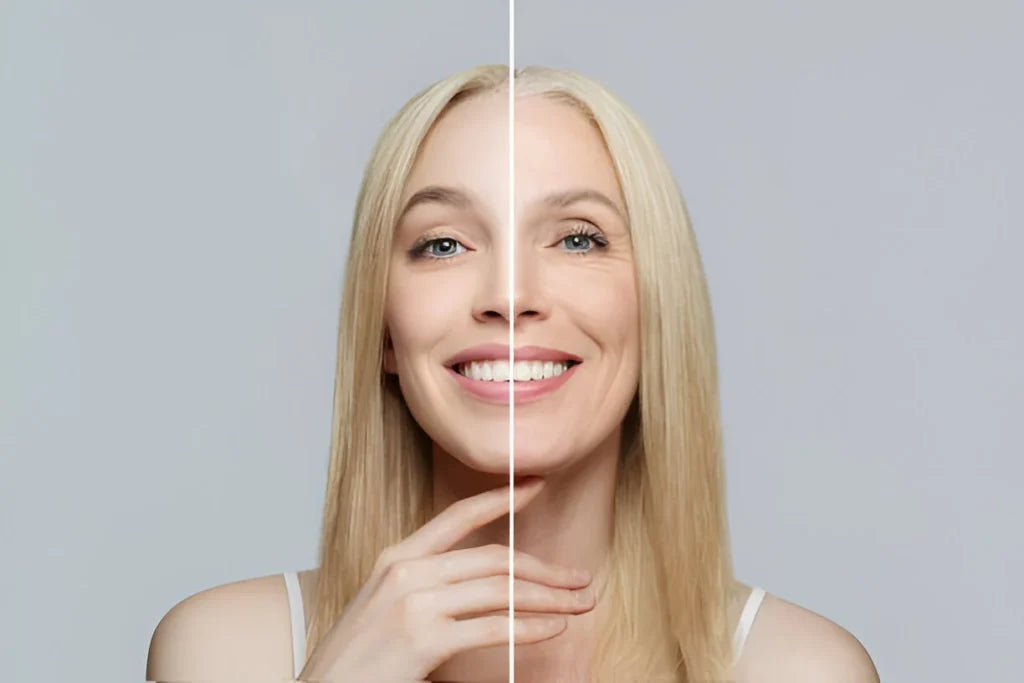 Outstanding Anti-Wrinkle Cream for Young Skin