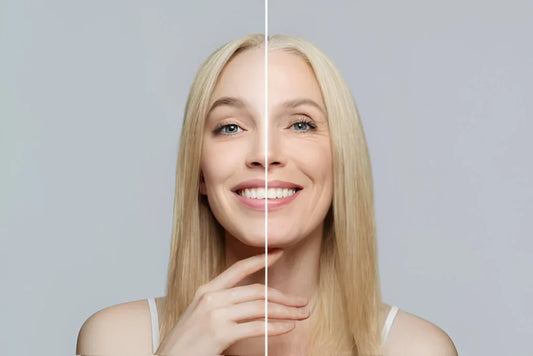 Outstanding Anti-Wrinkle Cream for Young Skin